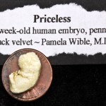 Pamela Wible MD – Human Embryo